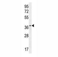 ZNF322B antibody western blot analysis in HL-60 lysate