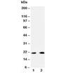 Western blot testing of PUMA antibody and Lane 1: HeLa; 2: rat kidney; Predicted molecular weight: 21/14/10/26kDa (isoforms alpha/beta/delta/gamma).