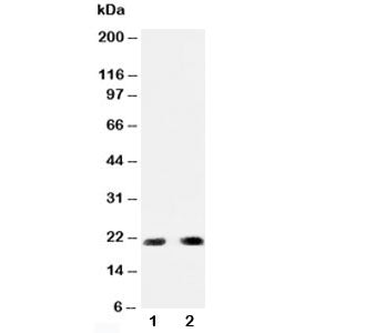 Western blot testing of PUMA antibody and Lane 1: HeLa; 2: rat kidney; Predicted molecular weight: 21/14/10/26kDa (isoforms alpha/beta/delta/gamma).