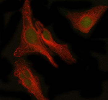 Immunofluorescent staining of PEPD using anti-PEPD antibody (green) and anti-Beta Tubulin antibody (red). PEPD was detected in immunocytochemical section of human HELA cell. Enzyme antigen retrieval was performed using IHC enzyme antigen retrieval reagent for 15 mins. The cells were blocked with 10% goat serum. And then incubated with 5 ug/ml rabbit anti-PEPD antibody and mouse anti-Beta Tubulin antibody overnight at 4oC.
