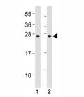 Western blot testing of SOCS1 antibody at 1:2000 dilution. Lane 1: mouse thymus lysate; 2: rat spleen lysate; Predicted molecular weight ~ 24 kDa.