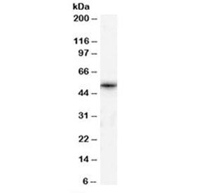Western blot testing of human testis lysate with TPTE antibody at 1ug/ml. Predicted molecular weight: ~60 kDa.