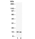 Western blot testing of 1) human A431 and 2) MCF7 cell lysate with S100A9 antibody. Expected/observed molecular weight ~14 kDa.