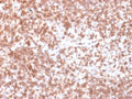 IHC testing of recombinant CD45 antibody and FFPE human lymph node (clone PTPRC/1975R). Required HIER: boil tissue sections in 10mM citrate buffer, pH 6, for 10-20 min followed by cooling at RT for 20 min.