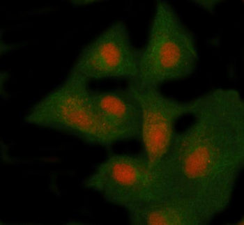 Immunofluorescent staining of NSMCE4A using anti-NSMCE4A antibody (red) and anti-Beta Tubulin antibody (green). NSMCE4A was detected in immunocytochemical section of cell. Enzyme antigen retrieval was performed using IHC enzyme antigen retrieval reagent for 15 mins. The cells were blocked with 10% goat serum. And then incubated with 5 ug/ml rabbit anti-NSMCE4A antibody and mouse anti-Beta Tubulin antibody overnight at 4oC.