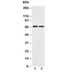 Western blot testing of GLUT12 antibody and Lane 1: PC-12; 2: A549 cell lysate