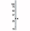 Western blot analysis of SIRT5 antibody in Jurkat lysate