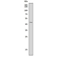 Western blot testing of human Jurkat cell lysate with CCR5 antibody. Predicted molecular weight ~41 kDa.