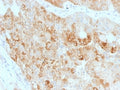 IHC staining of FFPE human kidney with ROR2 antibody. HIER: boil tissue sections in pH 9 10mM Tris with 1mM EDTA for 20 min and allow to cool before testing.