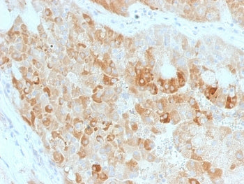 IHC staining of FFPE human kidney with ROR2 antibody. HIER: boil tissue sections in pH 9 10mM Tris with 1mM EDTA for 20 min and allow to cool before testing.