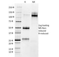 SDS-PAGE analysis of purified, BSA-free Matrix Metalloproteinase 3 antibody as confirmation of integrity and purity.