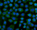 IF analysis of KEAP1 using anti-KEAP1 antibody (green). KEAP1 was detected in an immunocytochemical section of cells. Enzyme antigen retrieval was performed using IHC enzyme antigen retrieval reagent for 15 mins. The cells were blocked with 10% goat serum. And then incubated with 5 ug/ml rabbit anti-KEAP1 antibody overnight at 4oC. DyLight 488 Conjugated Goat Anti-Rabbit IgG was used as secondary antibody at 1:100 dilution and incubated for 30 min at 37oC. The section was counterstained with DAPI (blue).
