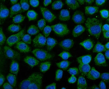 IF analysis of KEAP1 using anti-KEAP1 antibody (green). KEAP1 was detected in an immunocytochemical section of cells. Enzyme antigen retrieval was performed using IHC enzyme antigen retrieval reagent for 15 mins. The cells were blocked with 10% goat serum. And then incubated with 5 ug/ml rabbit anti-KEAP1 antibody overnight at 4oC. DyLight 488 Conjugated Goat Anti-Rabbit IgG was used as secondary antibody at 1:100 dilution and incubated for 30 min at 37oC. The section was counterstained with DAPI (blue).