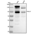 Western blot analysis of Palladin using anti-Palladin antibody. Lane 1: human Hela whole cell lysates, Lane 2: human whole cell lysates. After electrophoresis, proteins were transferred to a nitrocellulose membrane at 150 mA for 50-90 min. Blocked the membrane with 5% non-fat milk/TBS for 1.5 hour at RT.