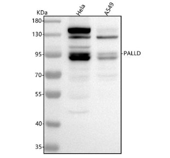 Western blot analysis of Palladin using anti-Palladin antibody. Lane 1: human Hela whole cell lysates, Lane 2: human whole cell lysates. After electrophoresis, proteins were transferred to a nitrocellulose membrane at 150 mA for 50-90 min. Blocked the membrane with 5% non-fat milk/TBS for 1.5 hour at RT.