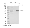 Immunoprecipitating (IP) GALNT2 in Hela whole cell lysate. Western blot analysis of GALNT2 using anti-GALNT2 antibody; Lane 1: Hela whole cell lysates (30ug); Lane 2: Rabbit control IgG instead of anti-GALNT2 antibody in Hela whole cell lysate; Lane 3: anti-GALNT2 antibody (2ug) + Hela whole cell lysate (500ug). After electrophoresis, proteins were transferred to a membrane.
