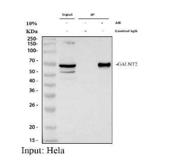 Immunoprecipitating (IP) GALNT2 in Hela whole cell lysate. Western blot analysis of GALNT2 using anti-GALNT2 antibody; Lane 1: Hela whole cell lysates (30ug); Lane 2: Rabbit control IgG instead of anti-GALNT2 antibody in Hela whole cell lysate; Lane 3: anti-GALNT2 antibody (2ug) + Hela whole cell lysate (500ug). After electrophoresis, proteins were transferred to a membrane.