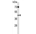 Western blot testing of human HeLa cell lysate with PHKG2 antibody. Predicted molecular weight ~44 kDa.