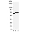 Western blot testing of SLC1A4 antibody and Lane 1: human U87; 2: rat brain; 3: mouse brain tissue lysate. Expected/observed size 60~80KD