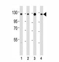 Western blot testing of anti-SIRT1 antibody at 1:2000 dilution. Lane 1: K562; 2: HeLa; 3: A549; 4: human testis lysate; Molecular weight: visualized from 80~120 kDa depending on post-translational modifications