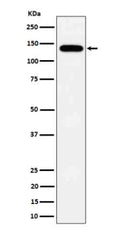 Western blot analysis of Tripeptidyl peptidase II expression in HepG2 cell lysate using TPP2 antibody. Predicted molecular weight ~138 kDa.