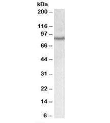 Western blot testing of Jurkat lysate with CRTC2 antibody at 0.3ug/ml. Predicted molecular weight: ~73 kDa, observed here at ~85 kDa.