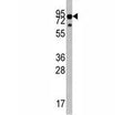 Western blot analysis of TrkA antibody and mouse liver tissue lysate. Observed molecular weight: 85~140 kDa depending on glycosylation level.