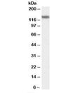 Western blot testing of human brain (amygdala, hippocampus, substantia nigra) lysate with PHLPP2 antibody at 0.1ug/ml. Predicted molecular weight: ~134kDa.