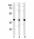 NeuroD1 antibody western blot analysis in 1) Y79 cell line, 2) mouse cerebellum and 3) rat brain tissue lysate.