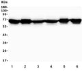 Western blot testing of human 1) Caco-2, 2) HeLa, 3) HepG2, 4) ThP-1, 5) U-2 OS and 6) PC-3 cell lysate with Merlin antibody. Predicted molecular weight ~69 kDa.
