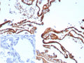 IHC staining of FFPE human lung tissue with recombinant Periostin antibody (clone POSTN/8523R). Inset: PBS used in place of primary Ab (secondary Ab negative control). HIER: boil tissue sections in pH 9 10mM Tris with 1mM EDTA for 20 min and allow to cool before testing.