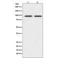Western blot testing of 1) human Jurkat and 2) rat spleen lysate with CD19 antibody. Expected molecular weight: 60-100 kDa depending on glycosylation level.