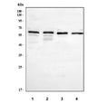 Western blot testing of Perforin antibody and Lane 1: HeLa; 2: COLO320; 3: HEPG2. Predicted/observed size ~61KD