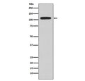 Western blot testing of Ramos cell lysate with NFAT2 antibody. Predicted molecular weight: ~101 kDa (isoform C).