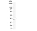 Western blot testing of Adiponectin antbody and rat heart tissue lysate. Expected/observed size ~30KD