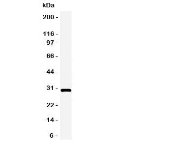 Western blot testing of Adiponectin antbody and rat heart tissue lysate. Expected/observed size ~30KD
