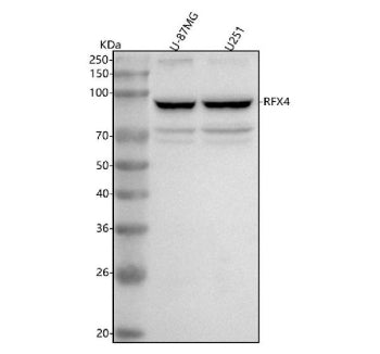 Western blot analysis of RFX4 using anti-RFX4 antibody. Lane 1: human U-87MG whole cell lysates, Lane 2: human U251 whole cell lysates. After electrophoresis, proteins were transferred to a nitrocellulose membrane at 150 mA for 50-90 min. Blocked the membrane with 5% non-fat milk/TBS for 1.5 hour at RT.