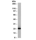 Western blot testing of Jurkat lysate with MAX antibody at 0.1ug/ml. Two forms of MAX may be observed: 16-17kDa and 21-22kDa.