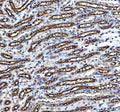 IHC staining of FFPE mouse kidney tissue with NKCC2 antibody, HRP-secondary and DAB substrate. HIER: boil tissue sections in pH8 EDTA for 20 min and allow to cool before testing.