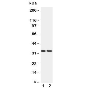 Western blot testing of CD20 antibody and Lane 1: Raji; 2: CEM lysate. Expected molecular weight ~33 kDa.