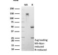 SDS-PAGE analysis of purified, BSA-free CD206 antibody (clone MRC1/9456) as confirmation of integrity and purity.