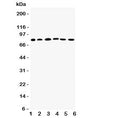 Western blot testing of Proprotein Convertase 1/3 antibody; Lane 1: rat liver; 2: (r) thymus; and human samples 3: A549; 4: HeLa; 5: COLO320; 6: PANC cell lysate