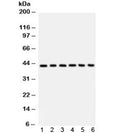 Western blot testing of 1) human placenta, 2) Jurkat, 3) CEM, 4) HL60, 5) rat spleen and 6) mouse spleen with CD62L antibody. Expected/observed molecular weight: 42~95 kDa depending on level of glycosylation.