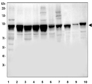 Western blot testing of 1) human HeLa, 2) human K562, 3) human MCF7, 4) human COLO-320, 5) human HepG2, 6) human HaCaT, 7) monkey COS-7, 8) rat NRK, 9) mouse lung and 10) mouse NIH 3T3 cell lysate with NUP98. Predicted molecular weight ~98 kDa.