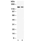 Western blot testing of human 1) HeLa and 2) MCF7 cell lysate with SAFB antibody at 0.5ug/ml. Predicted molecular weight: ~103 kDa but routinley observed at ~150 kDa.