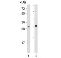 Western blot testing of 1) mouse heart and 2) human skeletal muscle lysate with DIO2 antibody. Predicted molecular weight ~31 kDa.