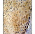 IHC staining of FFPE human skin tissue with GSDMA antibody. HIER: steam section in pH6 citrate buffer for 20 min and allow to cool prior to staining.