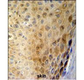 IHC staining of FFPE human skin tissue with GSDMA antibody. HIER: steam section in pH6 citrate buffer for 20 min and allow to cool prior to staining.