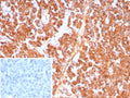 IHC staining of FFPE human pancreas tissue with Carboxypeptidase A1 antibody (clone CPA1/8784). Inset: PBS used in place of primary Ab (secondary Ab negative control). HIER: boil tissue sections in pH 9 10mM Tris with 1mM EDTA for 20 min and allow to cool before testing.