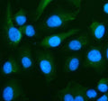 Immunofluorescent staining of RPS19 using anti-RPS19 antibody (green). RPS19 was detected in an immunocytochemical section of cells. Enzyme antigen retrieval was performed using IHC enzyme antigen retrieval reagent for 15 mins. The cells were blocked with 10% goat serum. And then incubated with 5 ug/ml rabbit anti-RPS19 antibody overnight at 4oC. DyLight 488 Conjugated Goat Anti-Rabbit IgG was used as secondary antibody at 1:500 dilution and incubated for 30 min at 37oC.